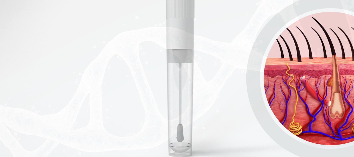 Dr. Gustavo Torres explores how genetic profiling is revolutionizing therapeutic strategies for androgenetic alopecia