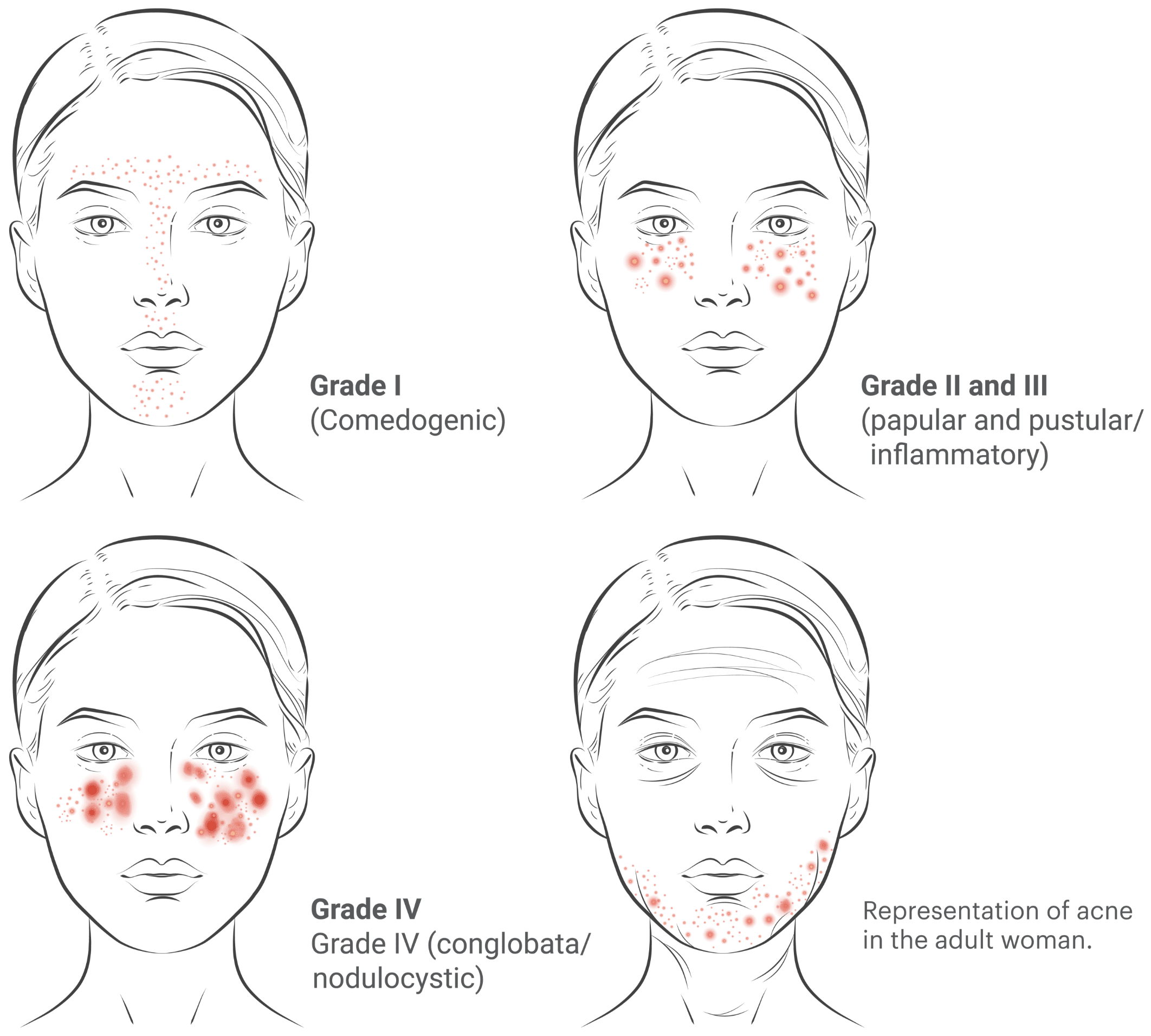 analysis-polymorphisms